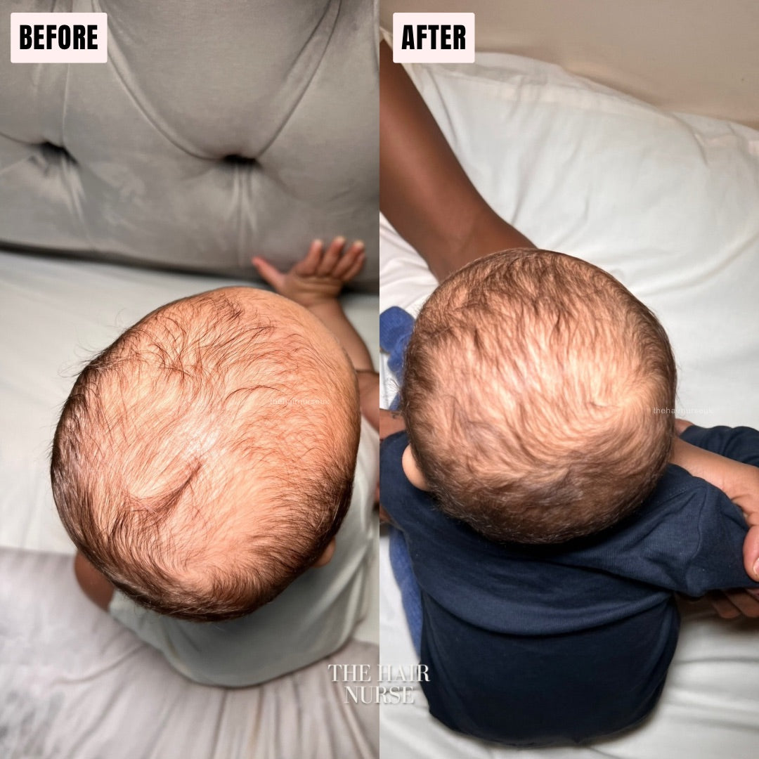 KIDS GENTLE SCALP STRENGTHENING OIL