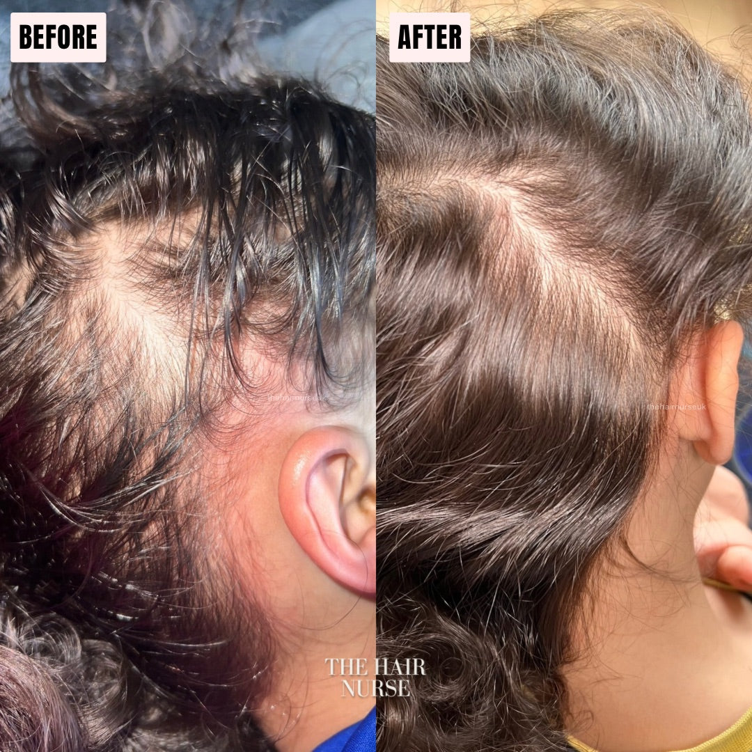 KIDS GENTLE SCALP STRENGTHENING OIL