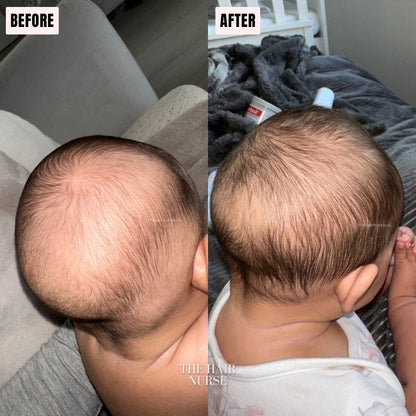 KIDS GENTLE SCALP STRENGTHENING OIL