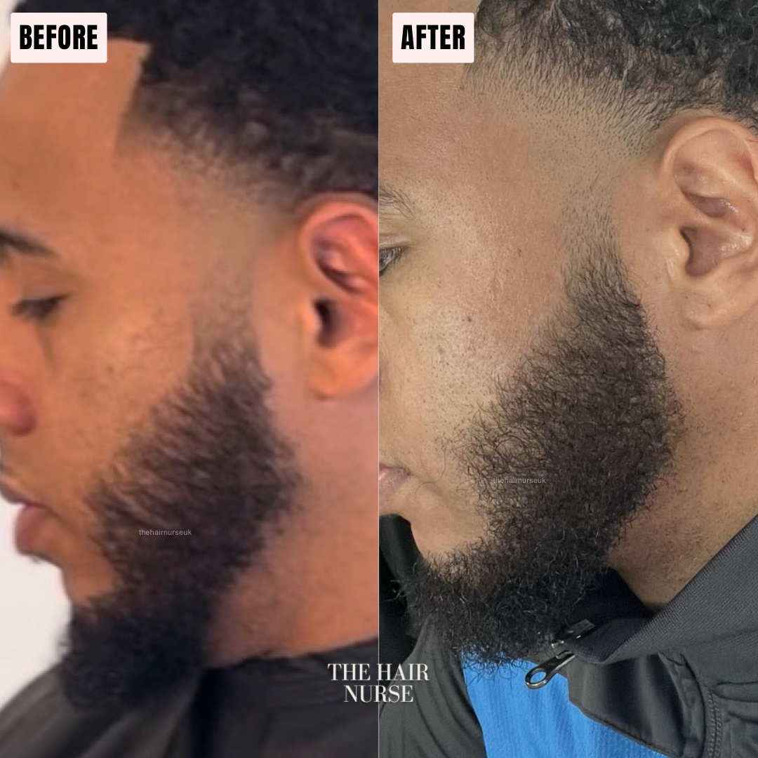 LUXURIOUS SCALP OIL