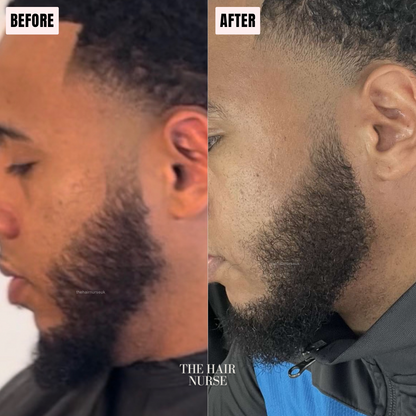 LUXURIOUS SCALP OIL